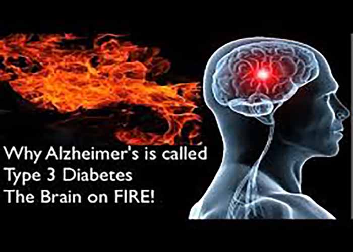 type 3 of diabetes, causes for alzheimer's disease